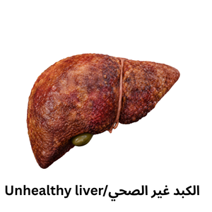 gamaged liver